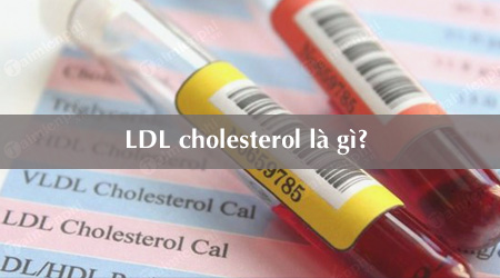 LDL cholesterol là gì? Tăng giảm có tác hại và lợi ích gì